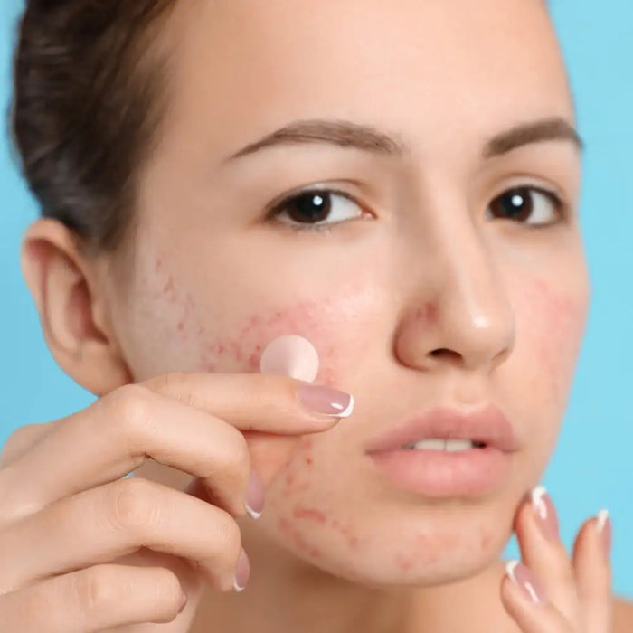 Invisible Acne Removal Pimple Patch